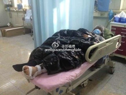 黄晓明被确诊为脚趾粉碎性骨折